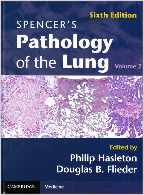 Spencers Pathology of the Lung 2 Part Set