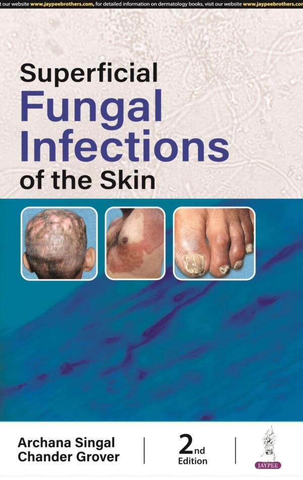 SUPERFICIAL FUNGAL INFECTIONS OF THE SKIN