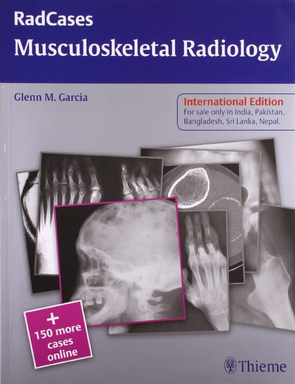 Radcases: Musculoskeletal Radiology (Ie)