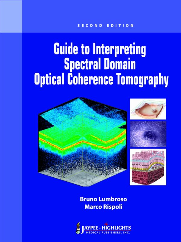 Guide to Interpreting Spectral Domain Optical Coherence Tomography