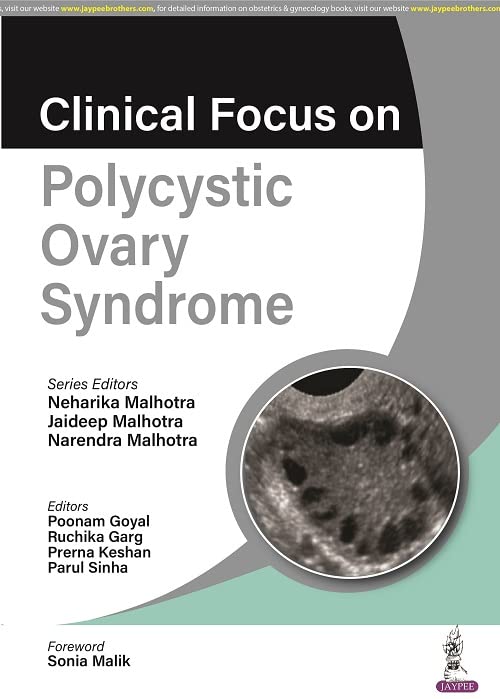 CLINICAL FOCUS ON POLYCYSTIC OVARY SYNDROME